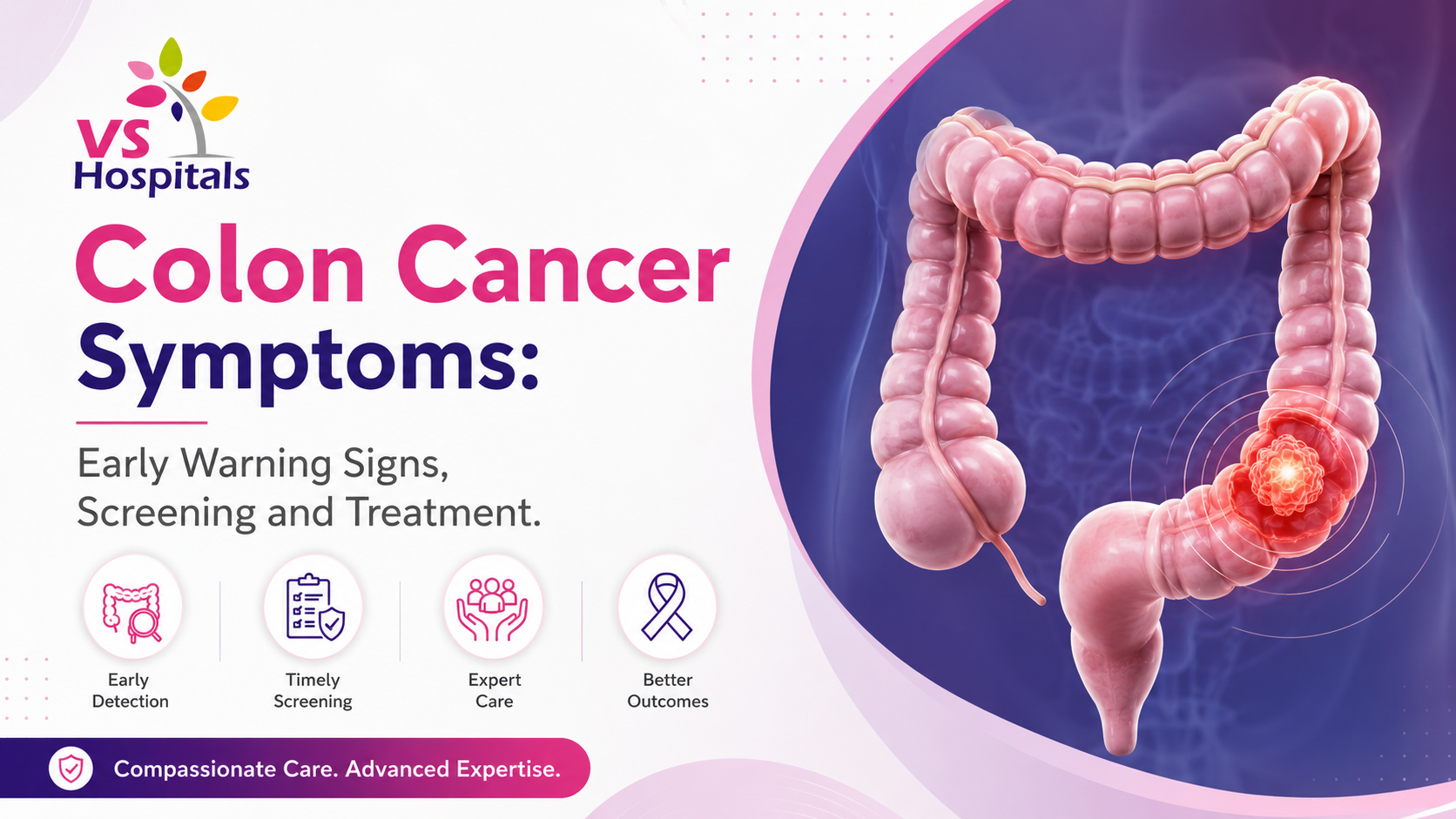 Colon Cancer Symptoms: When to Worry, Screening & Treatment