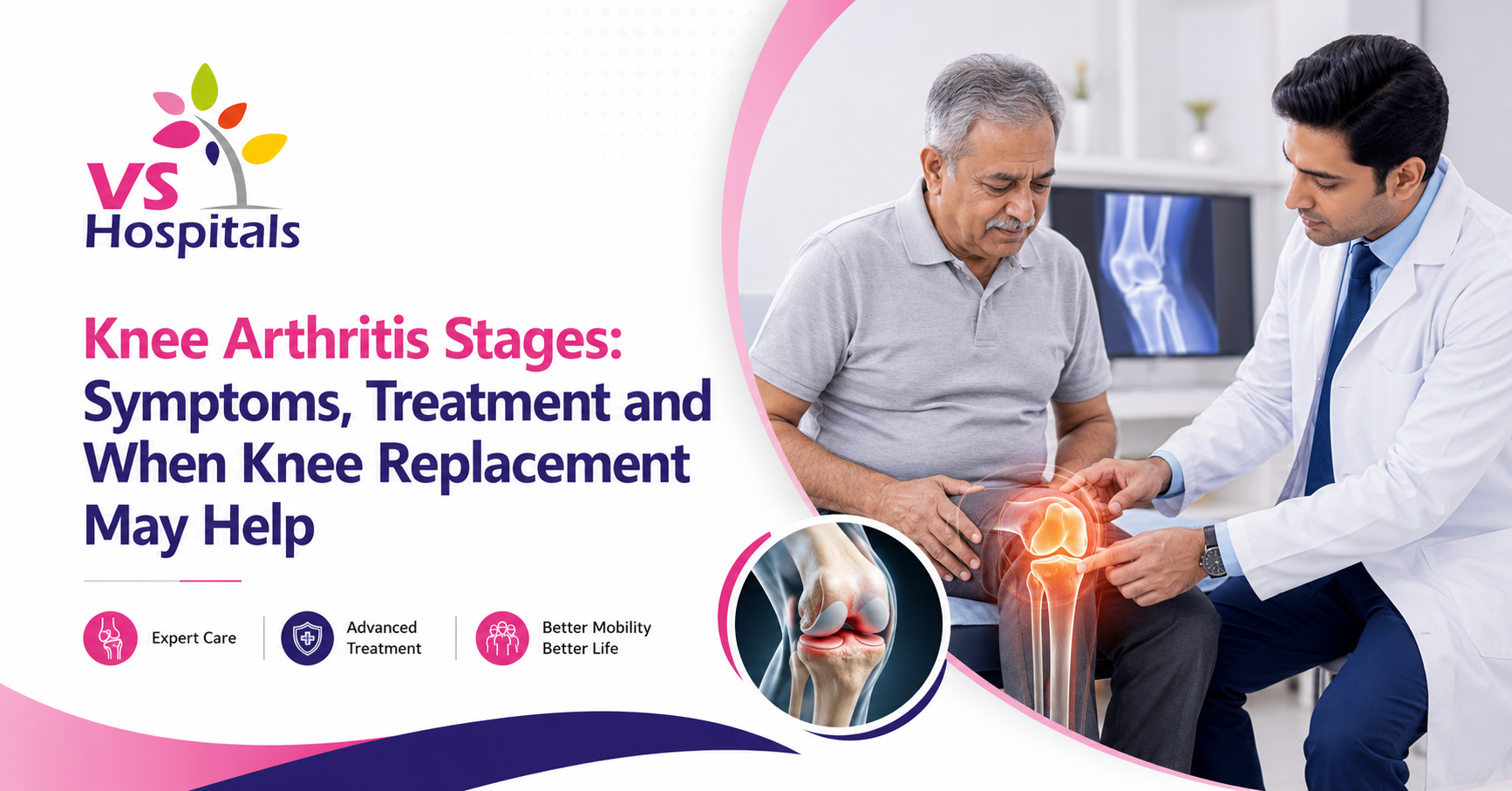 Knee Arthritis Stages